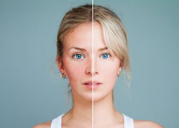 Ρετουσάρισμα φωτογραφιών