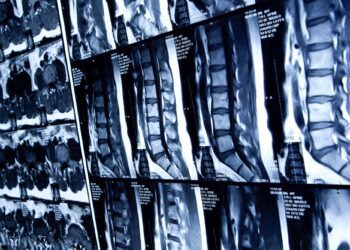 Σε ποιες παθήσεις είναι επιρρεπής η σπονδυλική στήλη;