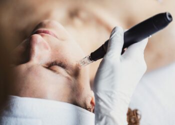 Microneedling: Πώς λειτουργεί για το δέρμα μας;