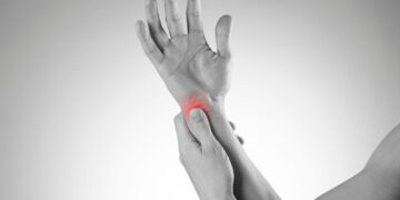 Ποια είναι η σχέση μεταξύ της ρευματοειδούς αρθρίτιδας και της ακμής;