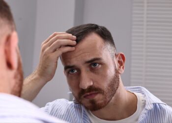 Τριχόπτωση: Γιατί οι άντρες χάνουν μαλλιά;