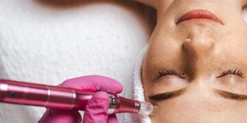 5 πράγματα που δεν γνωρίζατε για τη μεσοθεραπεία