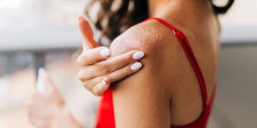 Πώς θα απαλλαγούμε οριστικά από την ξηροδερμία;