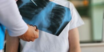 Πότε πρέπει ένας βήχας να μας ανησυχήσει;