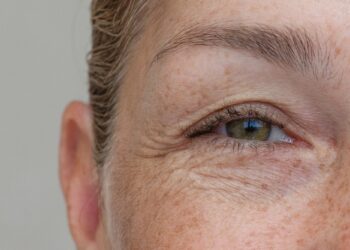 Υπάρχει τρόπος να μειώσουμε τις ρυτίδες έκφρασης