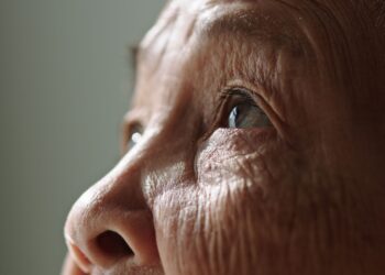 Πώς συνδέεται η ηλιακή ακτινοβολία με τη γήρανση του δέρματος;