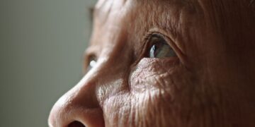 Πώς συνδέεται η ηλιακή ακτινοβολία με τη γήρανση του δέρματος;