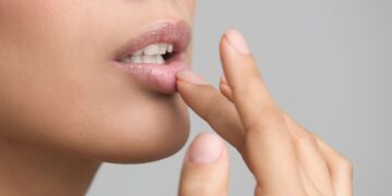 Σκασμένα χείλη; Δείτε ποιες βιταμίνες μπορεί να σας λείπουν