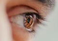Laser ματιών: Η λύση για μυωπία και αστιγματισμό