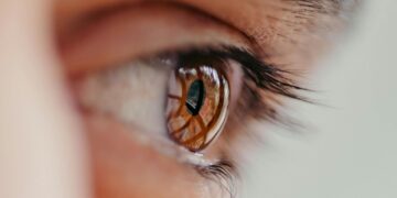 Laser ματιών: Η λύση για μυωπία και αστιγματισμό