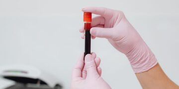 Χρυσό αίμα: Το ιατρικό μυστήριο που συναντάται εξαιρετικά σπάνια
