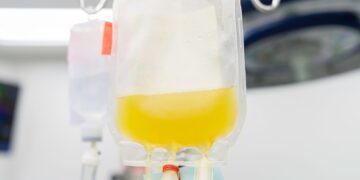 Τι είναι η πλασμαφαίρεση και πότε χρησιμοποιείται;